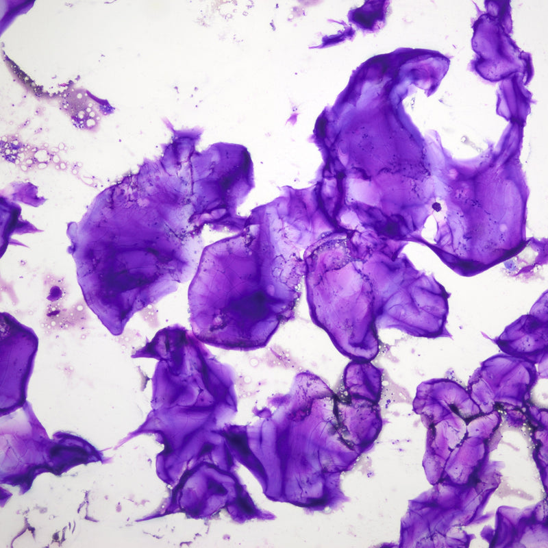 Hyaluronic Acid